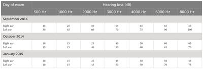 Case report: “Scared to deaf”: medical-legal evaluation of a suspected post -traumatic stress disorder”